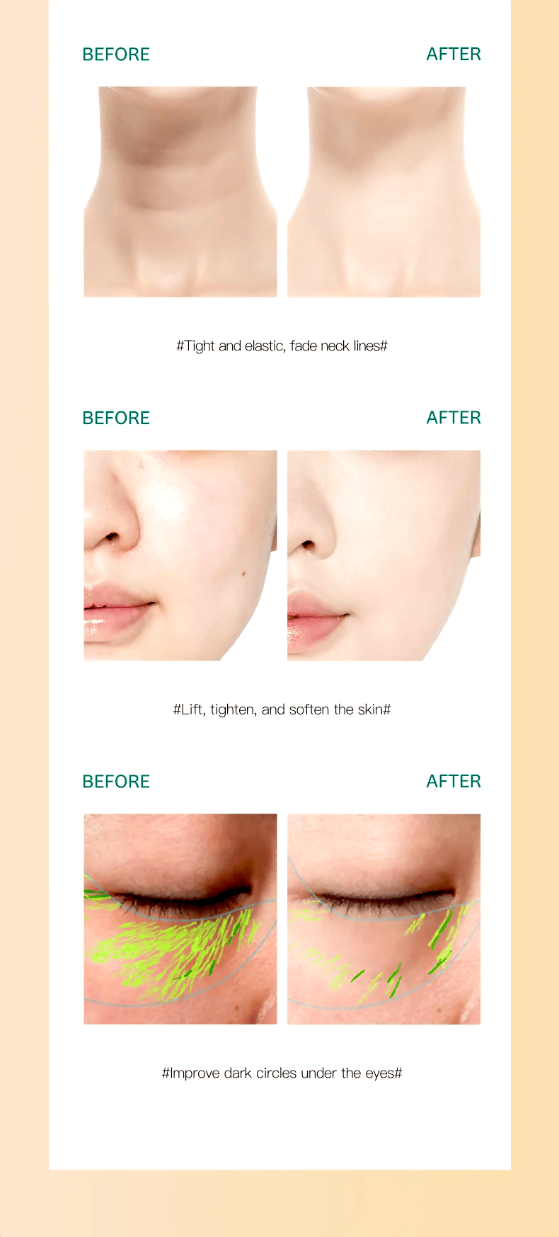 Delphy – Facial massager with three heads